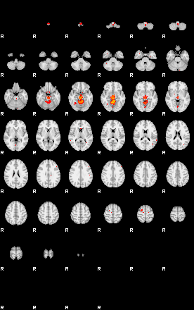 Patients 29430 57