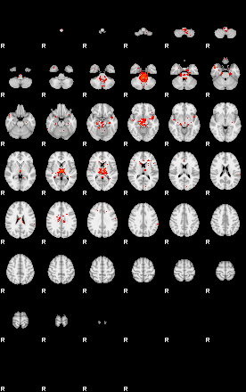 Patients 29539 1