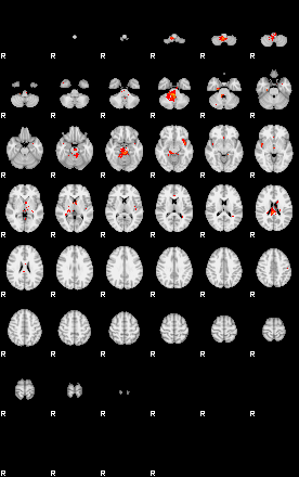 Patients 29561 135