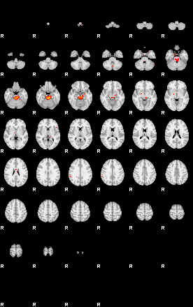 Patients 29665 13