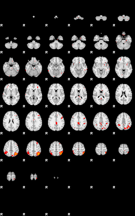 Patients 30187 34