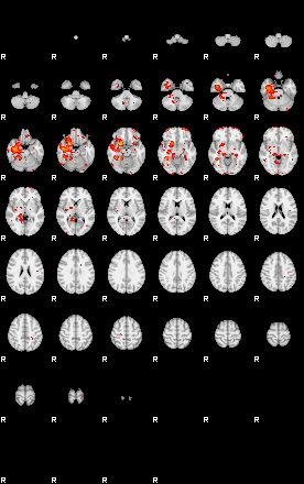 Patients 28754 4