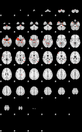 Patients 28903 106