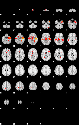 Patients 29102 81