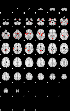 Patients 29180 24