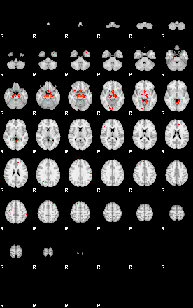 Patients 29273 29