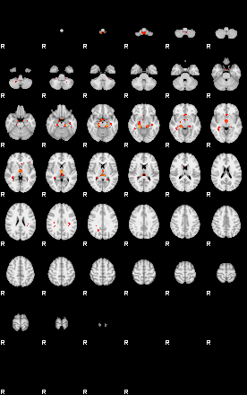 Patients 29288 199