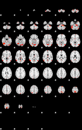 Patients 29541 93