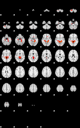 Patients 29293 117