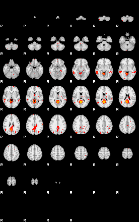 Patients 28815 128