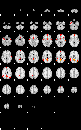 Patients 29174 131