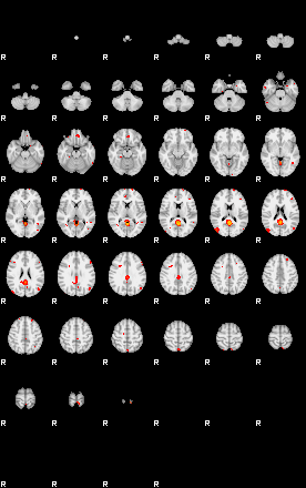 Patients 29175 125