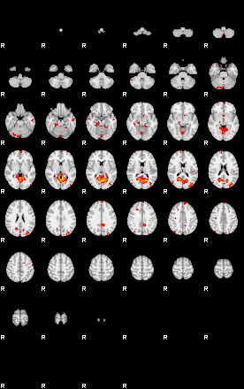 Patients 29160 26