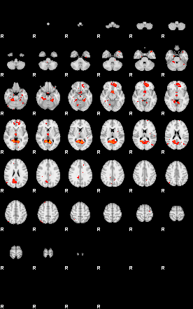 Patients 29203 33