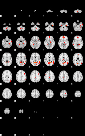 Patients 29280 25