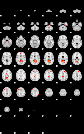 Patients 30188 26