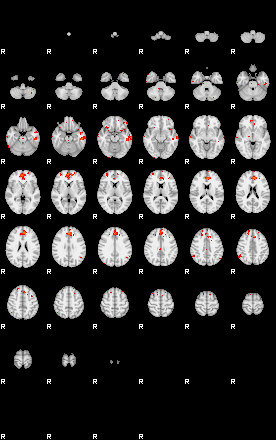 Patients 30010 57