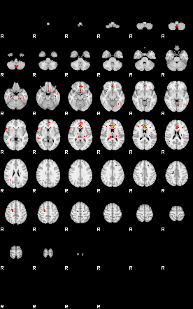 Patients 29415 153