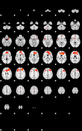 Patients 29216 200