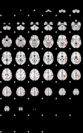 Patients 29017 158