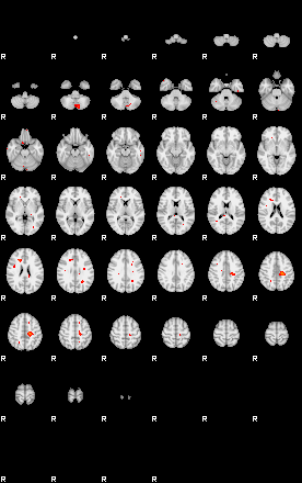 Patients 29199 184