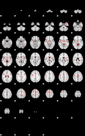 Patients 29609 187