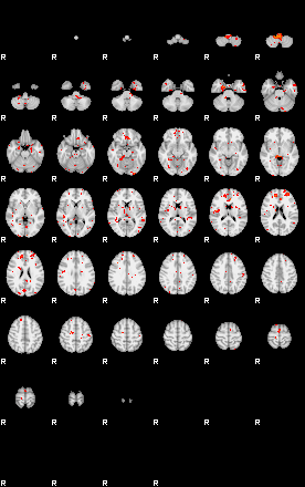 Patients 29613 29