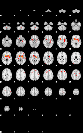 Patients 29029 103