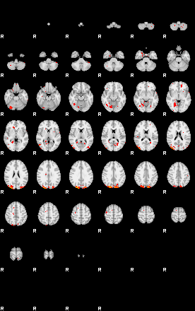 Patients 29055 13