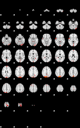 Patients 29191 125