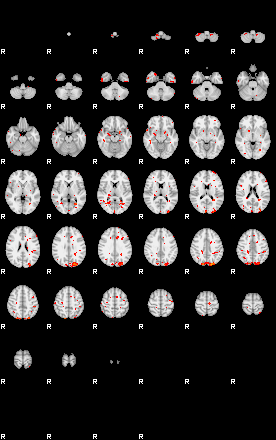 Patients 29613 55