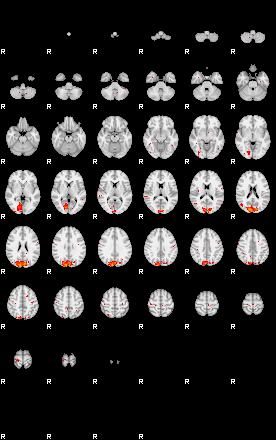 Patients 29009 171