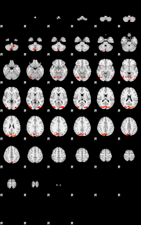 Patients 29027 12