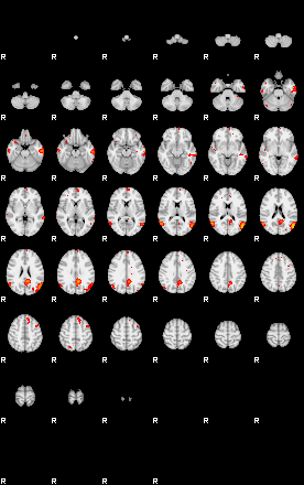 Patients 29163 124