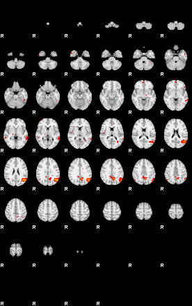 Patients 29403 130