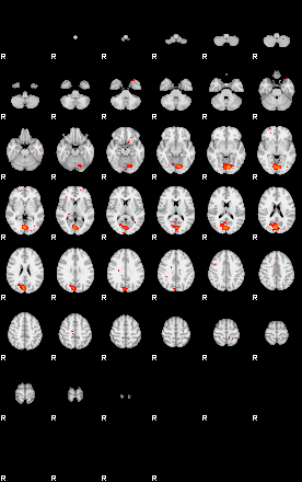 Patients 29188 193