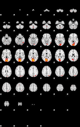 Patients 29799 125