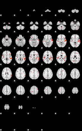 Patients 29205 137