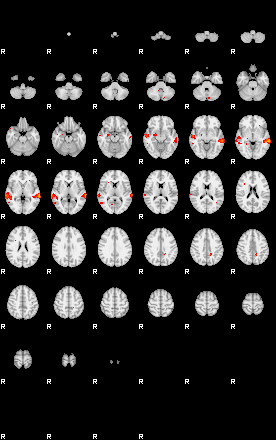 Patients 28718 85