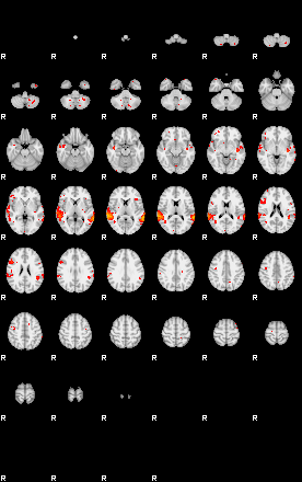 Patients 29053 53