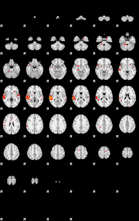 Patients 29107 154