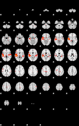 Patients 29178 101