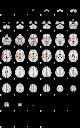 Patients 29344 135