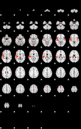 Patients 29410 167