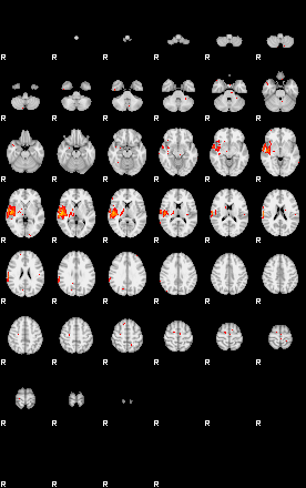 Patients 29511 148