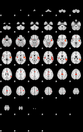 Patients 29169 92