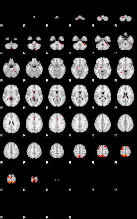 Patients 29675 199