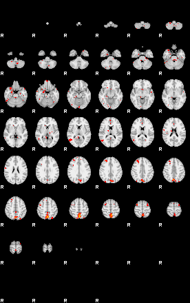 Patients 29015 17