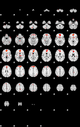 Patients 29015 143