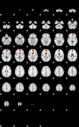 Patients 30171 125